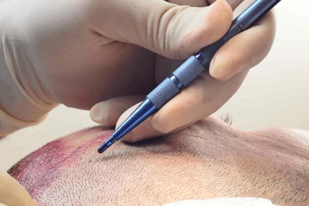 Valley Clinic procedure 4